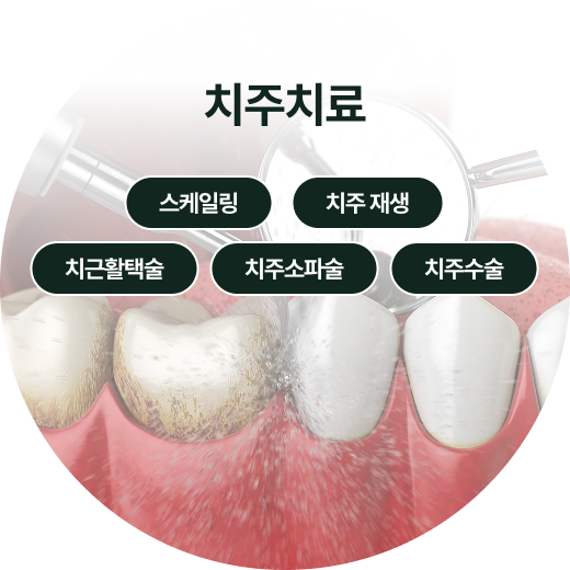 보철/심미치료