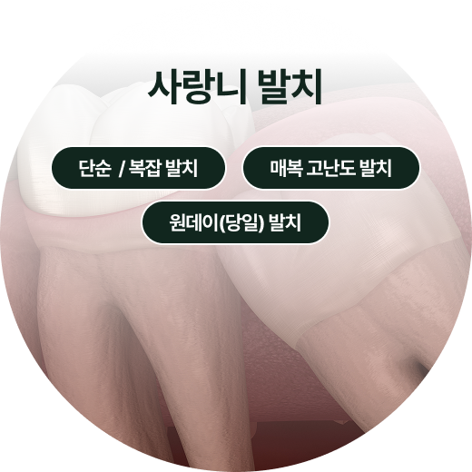 치주치료